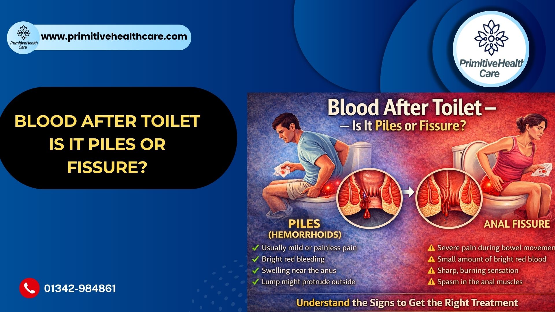 Blood After Toilet – Is It Piles or Fissure?